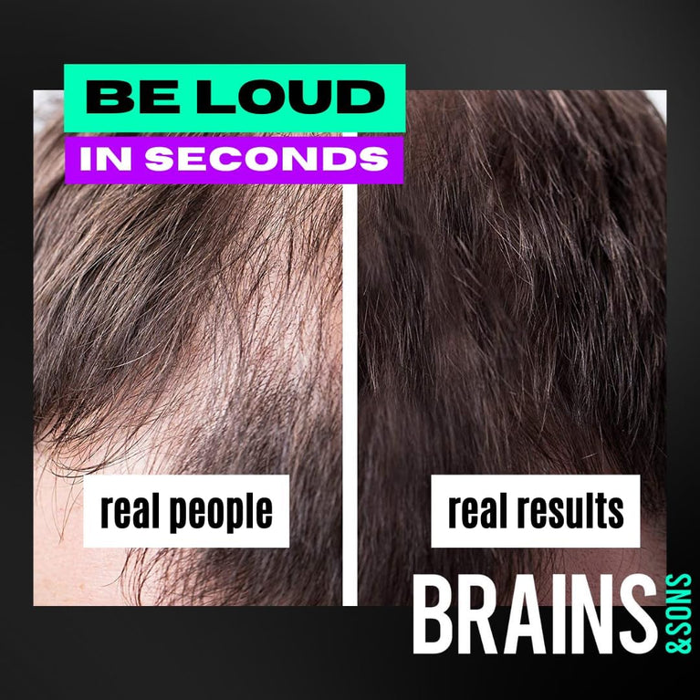 Thickening Hair Fibers by Brains & Son - Instantly Conceals Hair Loss and Thinning - Natural Keratin Powder (DARK BROWN)