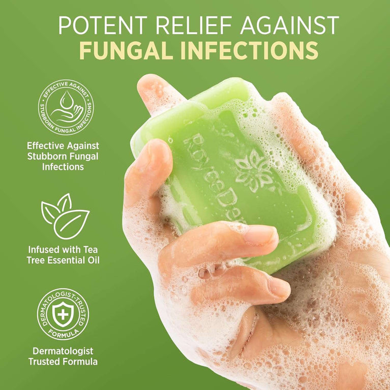 Antifungal Antibacterial Tea Tree Soap: Tea Tree Oil Soap for Face & Body Acne - Antifungal Antibacterial Treatment Soap for Athlete's Foot Tinea Versicolor Folliculitis Ringworm Jock Itch - 2 Pack