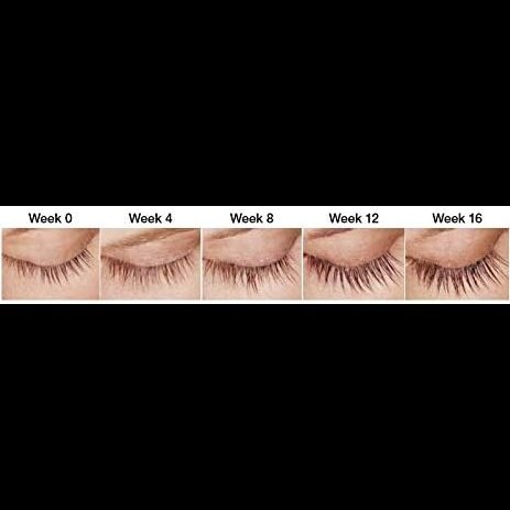 Vogue-Featured Spectaculash Rapid Eyelash Growth and Enhancing Serum - For Fuller, Longer, Thicker Lashes - Trusted UK Brand Dermaworks