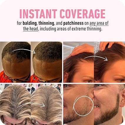 BOLDIFY Hairline Powder Instantly Conceals Hair Loss, Root Touch Up Hair Powder, Hair Toppers for Women & Men, Hair Fibers for Thinning Hair, Root Cover Up, Stain-Proof 48 Hour Formula (Dark Brown)