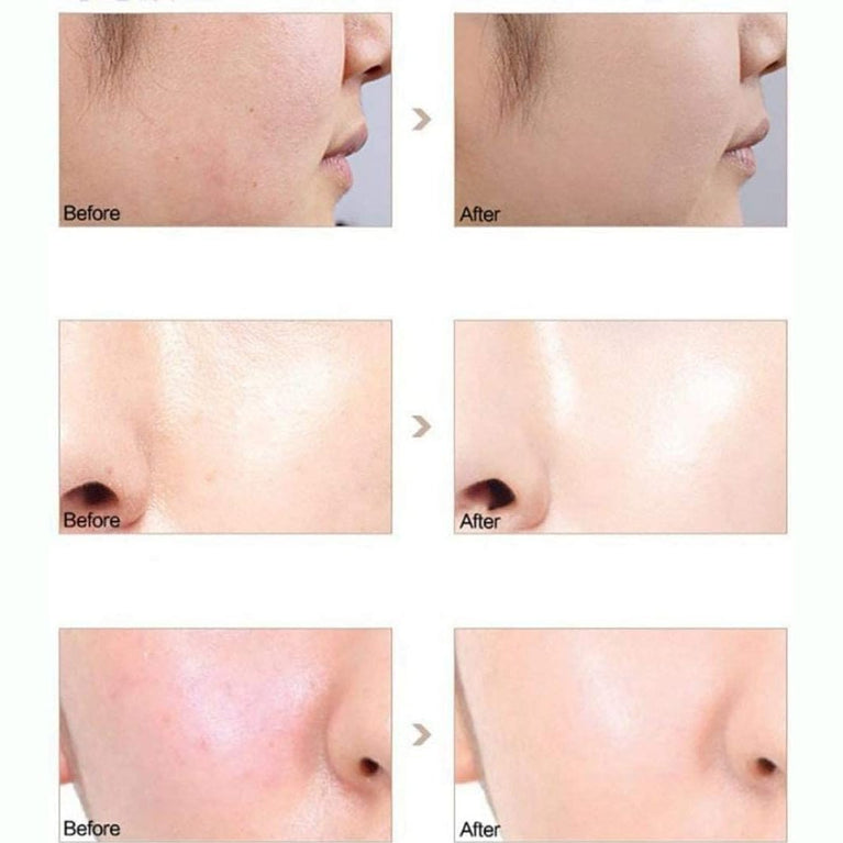 Ultimate 6-in-1 Matte Liquid Foundation Kit with Volcanic Oil-Control Rollers and Face Primer