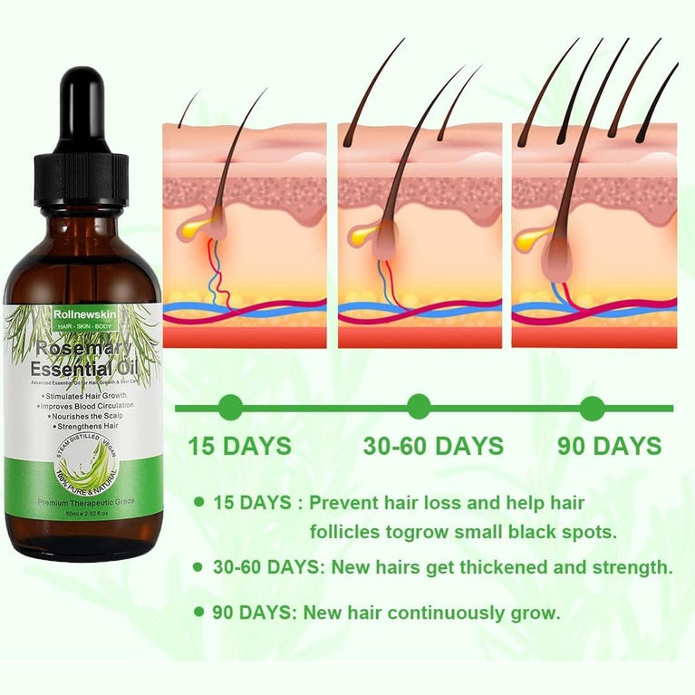 5-Pack Rollnewskin Aromatherapy Essential Rosemary Oil with Derma Roller 0.5mm - Pure Hair Growth & Loss Prevention Treatment for Hair, Eyebrows, Eyelashes & Skin Care