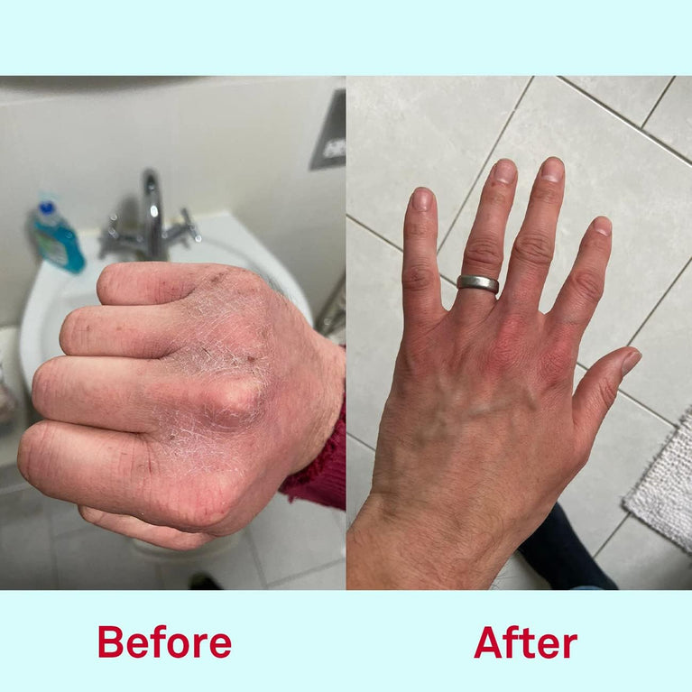 Nursem Gentle Hand Wash – 300ml | Natural, Ultra-Gentle Formula for Very Dry Hands