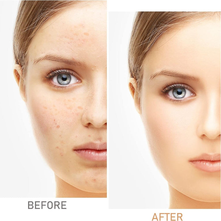 Boobeen Dual-Shade High Coverage Concealer - Perfect for Imperfection Coverage in Natural and Beige Tones