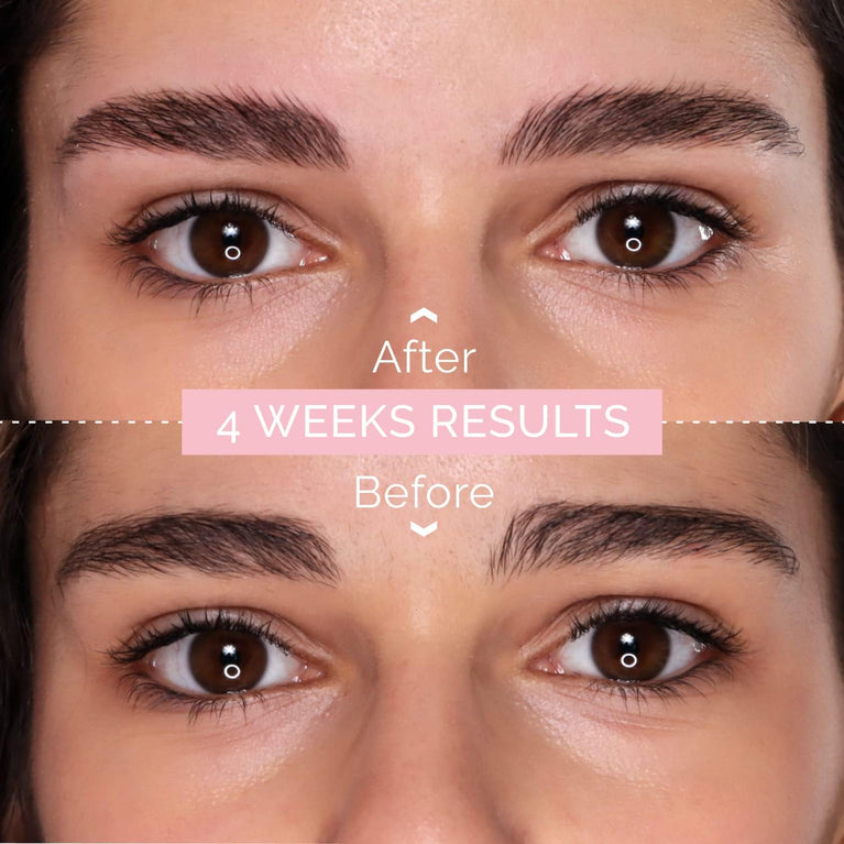RB RENATA BEAUTY Eyelash & Brow Renewal Serum – Nourishing & Repairing Lash Lift Aftercare – Deeply Conditioning Serum for Post-Lamination Brow & Eyelash Care – Daily Strength & Vitality Boost