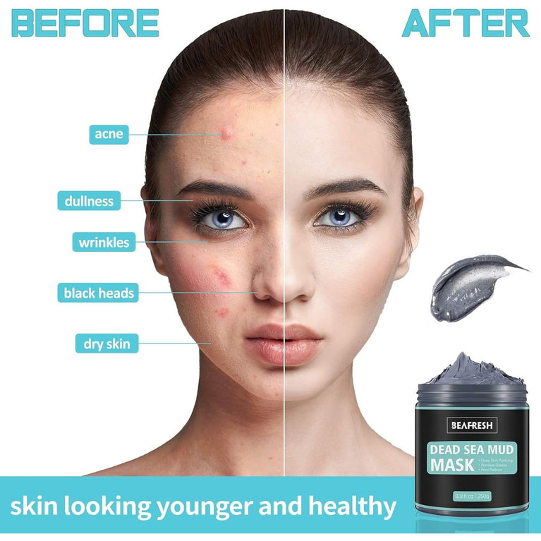 Detoxifying Dead Sea Mud Mask with Headband & Brush - Deep Cleansing Treatment for Face and Body