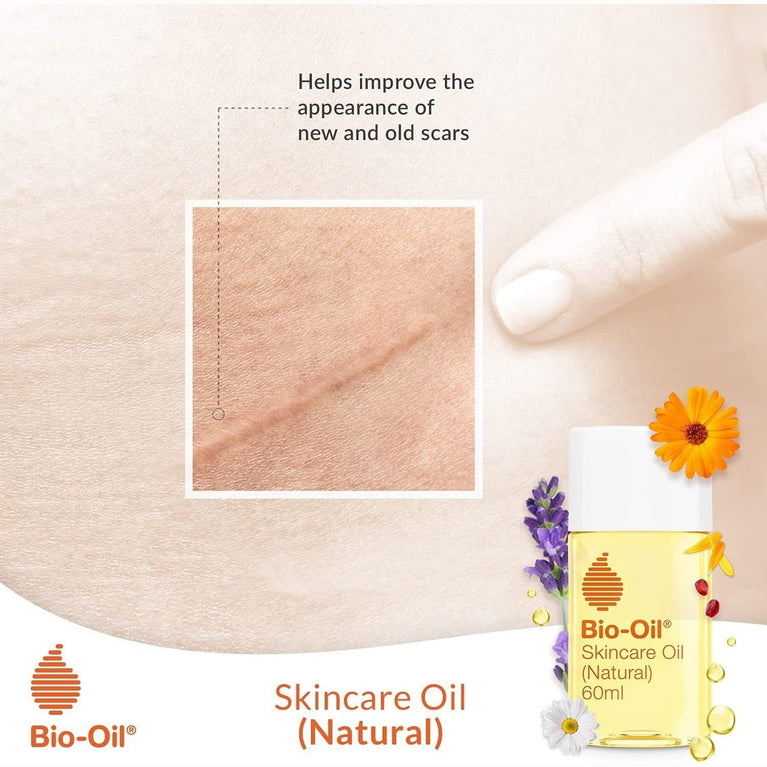 Bio-Oil Natural Skincare Oil - Nourishing Formula for Scars, Stretch Marks, and Uneven Skin Tone - 60 ml