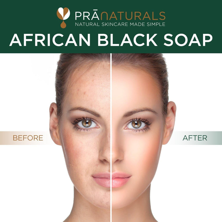 Ethically Sourced PraNaturals African Black Soap - 200g