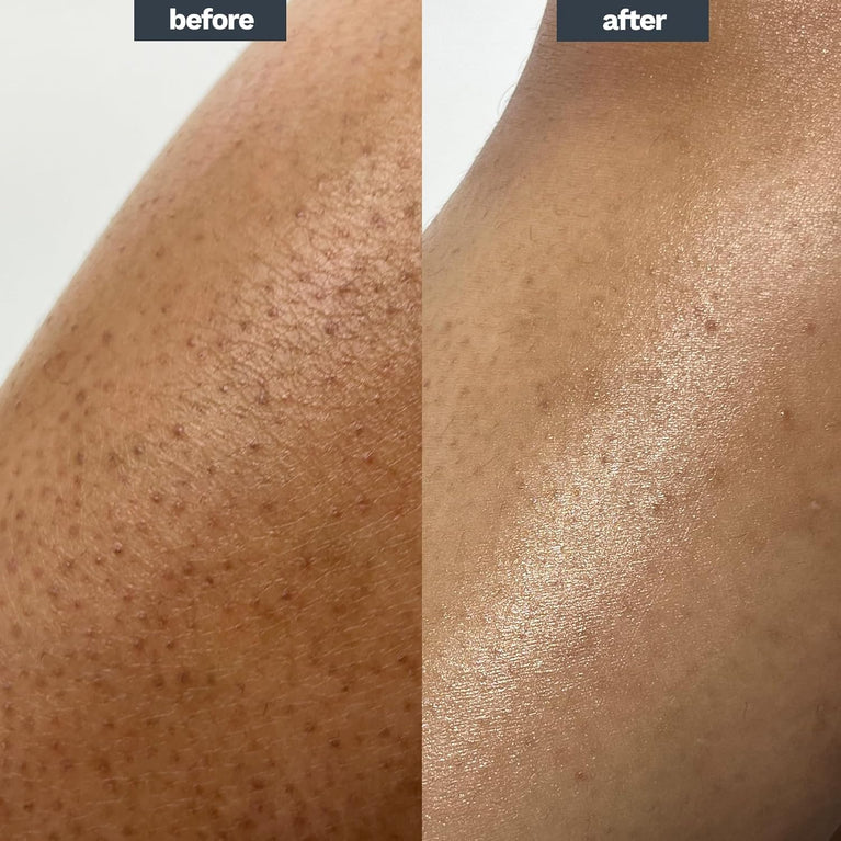 AMELIORATE Smoothing Body Exfoliant 150ml | Suitable for KP, Normal and Dry Skin | Softens Skin with Lasting Hydration for up to 8 hours | Dermatologist Approved and Clinically Proven