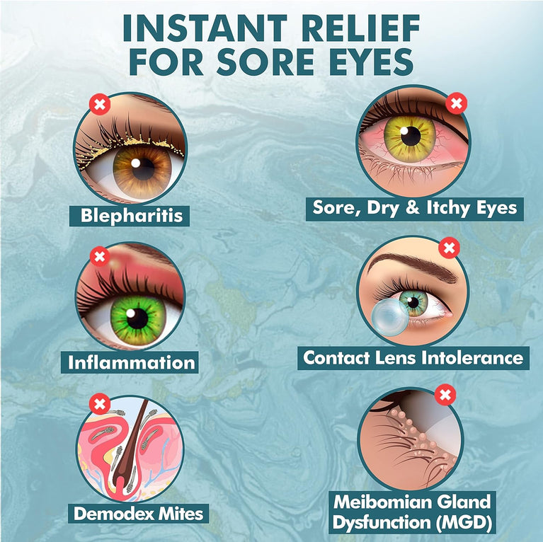 Rapid Relief Hypochlorous Acid 0.02% Eye and Lash Cleanser | Gentle & Organic Formula for Dry Eyes, Styes, and Blepharitis Relief, 30mL Soothing Spray