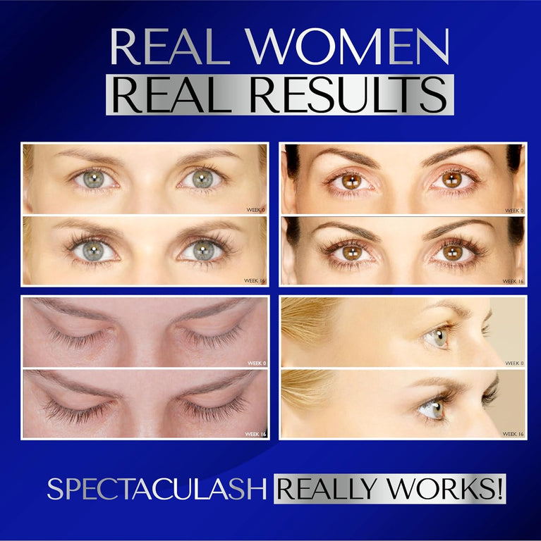 Vogue-Featured Spectaculash Rapid Eyelash Growth and Enhancing Serum - For Fuller, Longer, Thicker Lashes - Trusted UK Brand Dermaworks