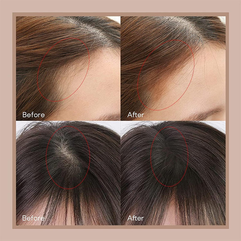 Hairline Powder Hair Root Touch Up, Instantly Conceals Hair Loss And Fills In Receding Hairlines Forehead Side Hair Filler Sweatproof Hairline Finishing Stick For Women Men (Medium Brown & Brown)