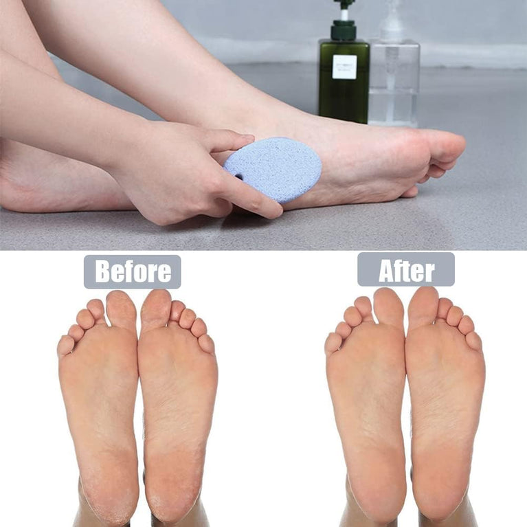MAYKI Natural Lava Pumice Stone Duo for Feet, Hands & Body - Effective Callus Remover & Foot Scrubber, Perfect for Men & Women's Dead or Hard Skin Care