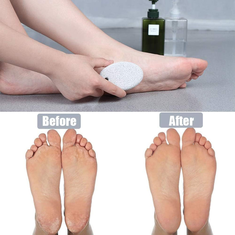 MAYKI Natural Lava Pumice Stone Duo for Feet, Hands & Body - Effective Callus Remover & Foot Scrubber, Perfect for Men & Women's Dead or Hard Skin Care