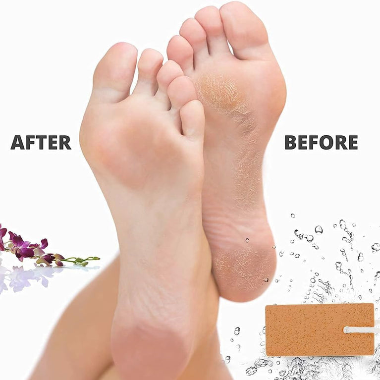Natural Pumice Stone Foot Scrubber for Exfoliation – Effective Callus Remover and Dead Skin Eradicator for Hands and Feet, Easy To Use and Stylishly Compact