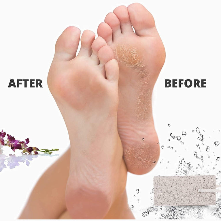 Natural Pumice Stone Foot Scrubber for Exfoliation – Effective Callus Remover and Dead Skin Eradicator for Hands and Feet, Easy To Use and Stylishly Compact