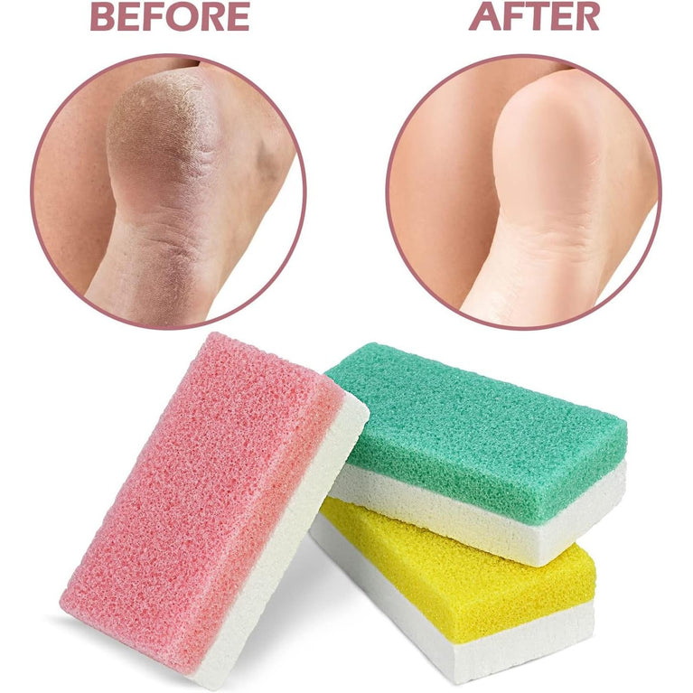 Premium 6-Pack Dual-Sided Foot Pumice Stone, Versatile Callus Scrubber and Pedicure Exfoliator for Soft Skin