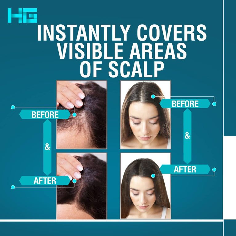 Hair Genetics Dark Brown Root Touch Up Powder with Full Grey Coverage, Ideal for Eyebrows and Beards