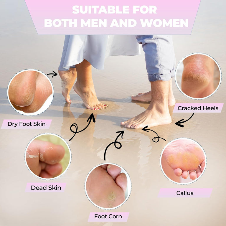 Nico Stevens Dual-Action Pumice Stone and PU Exfoliator - Superior Callus and Corn Remover for Hard Dry Skin - Perfect for Men & Women - Essential Pedicure Tool for Smooth Skin (Pink)