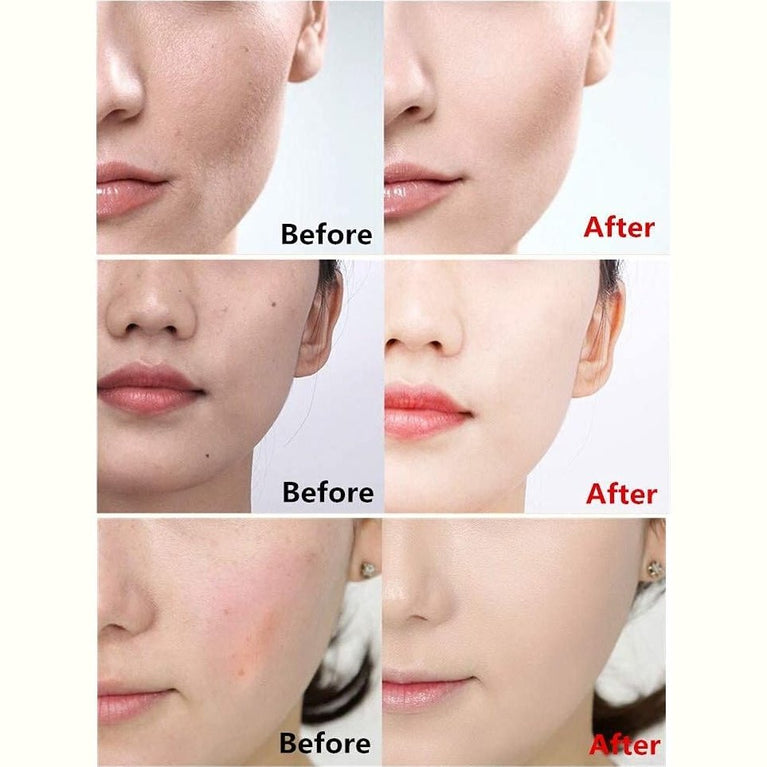 All-in-One Mushroom Head CC Cream: Concealer, Moisturizer & Brightening Foundation for All Skin Types